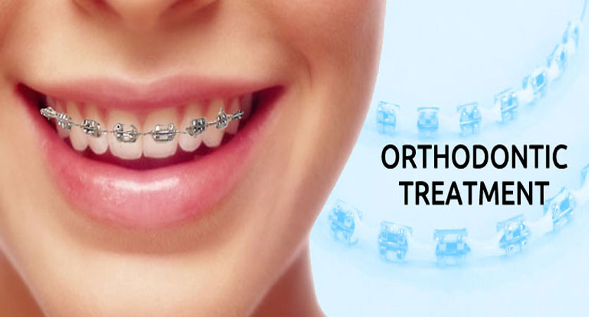 Benefits And Reasons For Orthodontic Treatment Healthy Mindz 3183