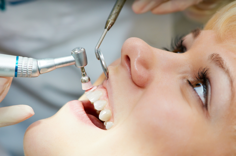 Deep Cleaning Teeth Cost Delta Dental PPO Providers